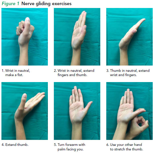 Carpal tunnel syndrome SingHealth