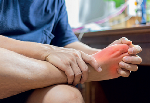 Managing gout effectively