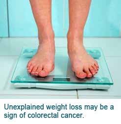Colorectal Cancer Unexplained Weight Loss